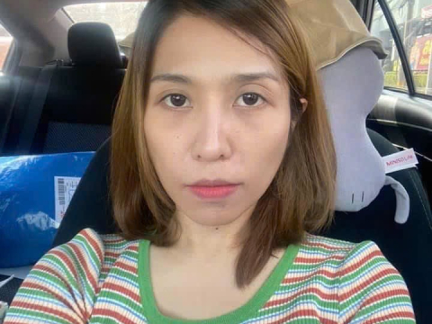 album Cấy HA xóa nhăn