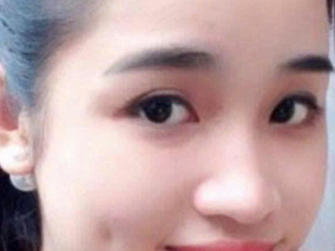 Má lúm đồng tiền