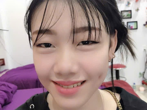 Má lúm đồng tiền