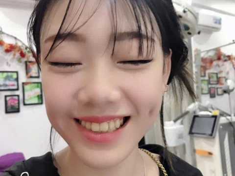 Má lúm đồng tiền